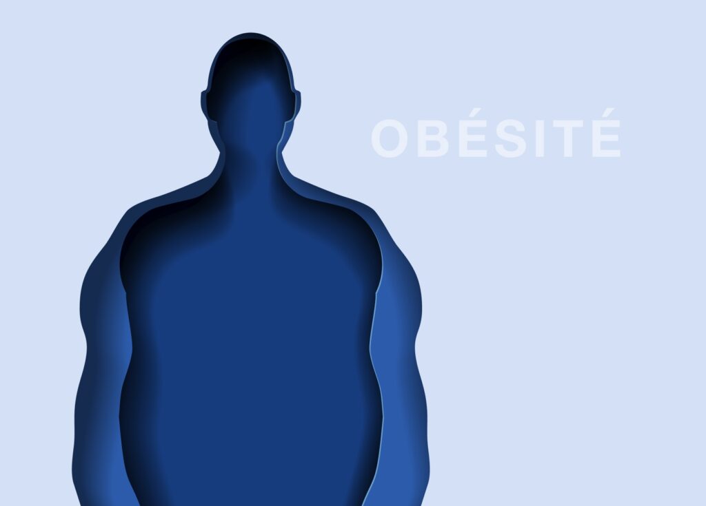 Obésité causes et traitements Institut de lObésité Paris Centre